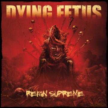 Dying Fetus: Reign Supreme [Winyl]