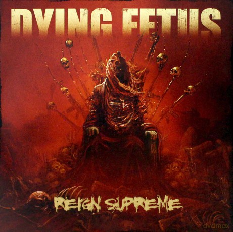 Dying Fetus: Reign Supreme [Winyl]