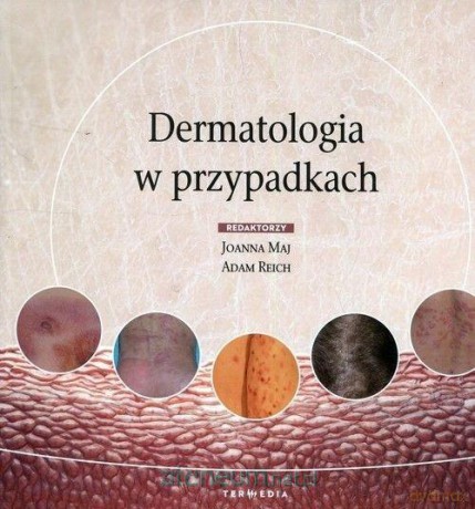 Dermatologia w przypadkach [KSIĄŻKA]