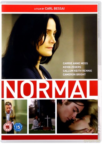 Normal [DVD]