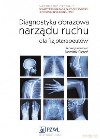 Diagnostyka obrazowa narządu ruchu - Dominik Sieroń [KSIĄŻKA]