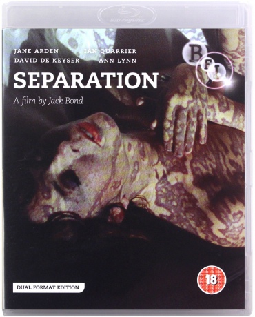 Separation [Blu-Ray]+[DVD]