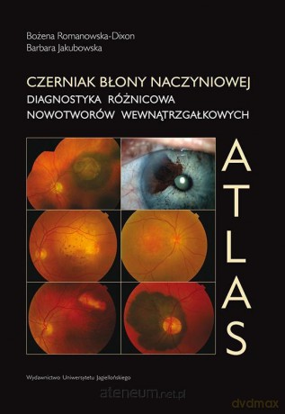 Czerniak błony naczyniowej Atlas - Bożena Romanowska-Dixon, Barbara Jakubowska [KSIĄŻKA]