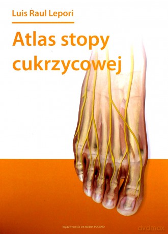 Atlas stopy cukrzycowej - Raul Lepori [KSIĄŻKA]