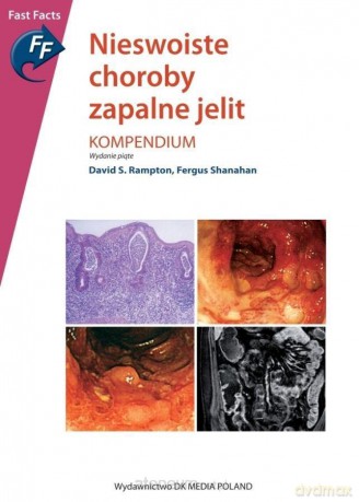 Nieswoiste choroby zapalne jelit - David S. Rampton [KSIĄŻKA]