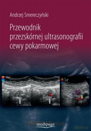 Przewodnik przezskórnej ultrasonografii cewy - Andrzej Smereczyński [KSIĄŻKA]