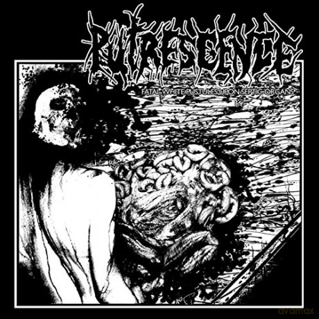 Putrescence: Fatal White Pustules Upon Septic Organs [CD]