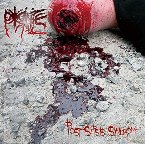 Porifice: Post-Sepsis Syndrome [CD]