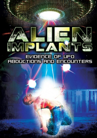 Alien Implant [DVD]