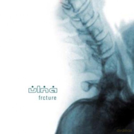 Ulna: Frcture [CD]