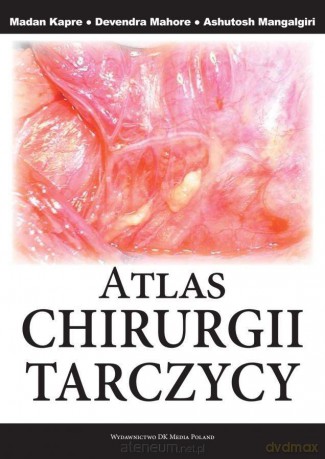 Atlas Chirurgii Tarczycy - Ashutosh Mangalgiri, Devendra Mahore, Madam Kapre [KSIĄŻKA]