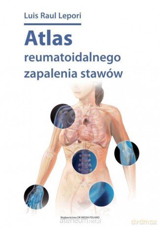Atlas reumatoidalnego zapalenia stawów - Luis Raul Lepori [KSIĄŻKA]