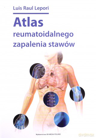Atlas reumatoidalnego zapalenia stawów - Luis Raul Lepori [KSIĄŻKA]