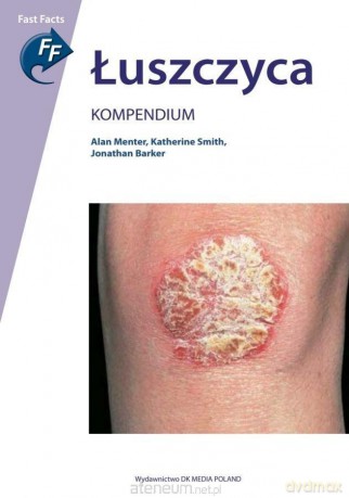 Łuszczyca. Kompendium - Alan Menter, Jonathan Barker, Katherine Smith [KSIĄŻKA]