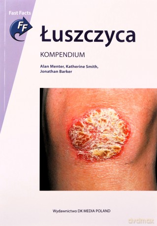 Łuszczyca. Kompendium - Alan Menter, Jonathan Barker, Katherine Smith [KSIĄŻKA]