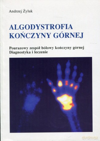 Algodystrofia kończyny górnej - Andrzej Żyluk [KSIĄŻKA]