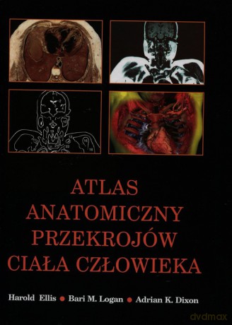Atlas anatomiczny przekrojów ciała człowieka - Harold Ellis, Bari M. Logan [KSIĄŻKA]