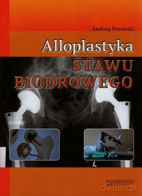 Alloplastyka stawu biodrowego - Andrzej Pozowski [KSIĄŻKA]