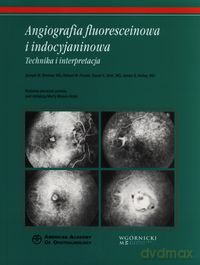 Angiografia fluoresceinowa i indocyjaninowa - Joseph W. Berkow, Robert W. Flower [KSIĄŻKA]