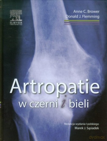 Artropatie w czerni i bieli - Anne C. Brower, Donald J. Flemming [KSIĄŻKA]