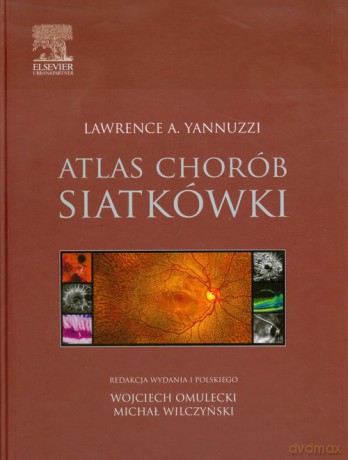 Atlas chorób siatkówki - Lawrence A. Yannuzzi [KSIĄŻKA]
