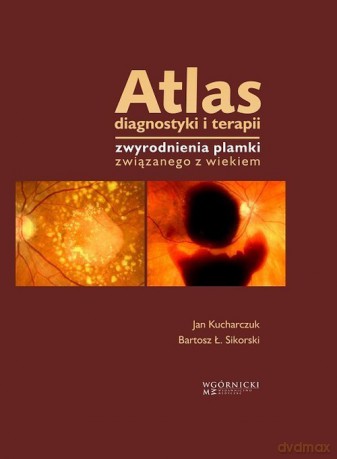 Atlas diagnostyki i terapii zwyrodnienia plamki związanego z wiekiem - Jan Kucharczuk, Bartosz Ł. Sikorski [KSIĄŻKA]