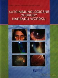 Autoimmunologiczne choroby narządu wzroku - Jacek J. Kański, Agnieszka Kubicka-Trząska [KSIĄŻKA]