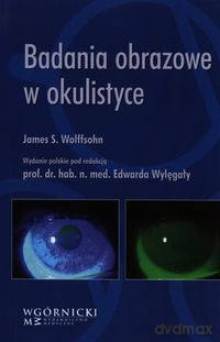 Badania obrazowe w okulistyce - James S. Wolffsohn [KSIĄŻKA]