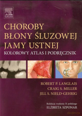 Choroby błony śluzowej jamy ustnej - Robert P. Langlais, Craig S. Miller [KSIĄŻKA]