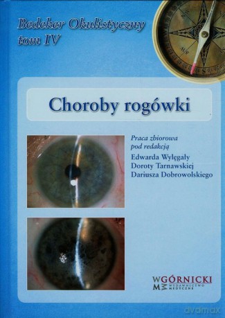 Choroby rogówki (Tom 4) [KSIĄŻKA]
