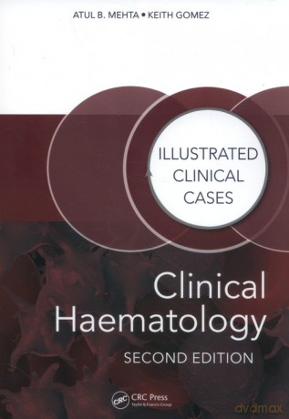 Clinical Haematology - Atul Bhanu Mehta, Keith Gomez [KSIĄŻKA]