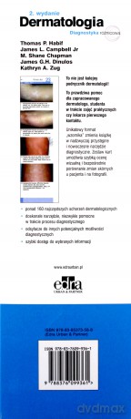 Dermatologia Diagnostyka różnicowa - Thomas P. Habif, James L. Campbell [KSIĄŻKA]