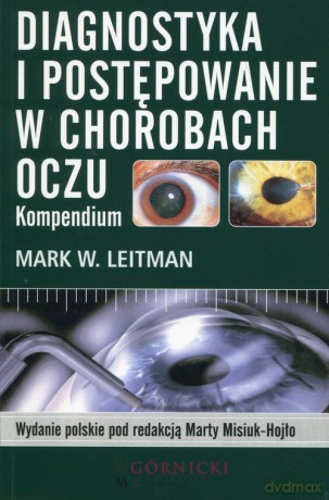 Diagnostyka i postępowanie w chorobach oczu - Mark W. Leitman [KSIĄŻKA]