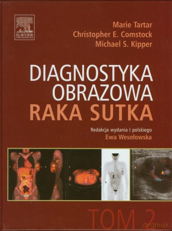Diagnostyka obrazowa raka sutka (Tom 2) - Marie Tartar, Christopher E. Comstock [KSIĄŻKA]