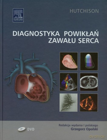Diagnostyka powikłań zawału serca - Stuart J. Hutchison [KSIĄŻKA]