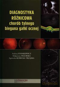 Diagnostyka różnicowa chorób tylnego bieguna gałki ocznej - Andrzej Stankiewicz, Małgorzata Figurska [KSIĄŻKA]