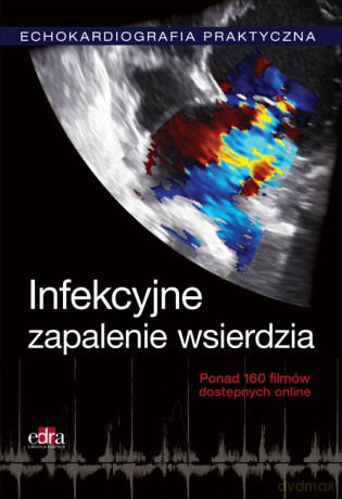 Echokardiografia Praktyczna Infekcyjne zapalenie wsierdzia [KSIĄŻKA]