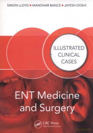 ENT Medicine and Surgery - Simon Lloyd, Manohar Bance [KSIĄŻKA]