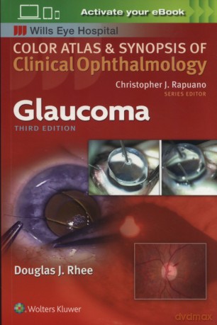 Glaucoma - Douglas Rhee [KSIĄŻKA]