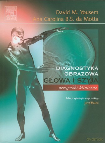 Głowa i szyja - David M. Yousem, Ana Carolina B. S. Motta [KSIĄŻKA]