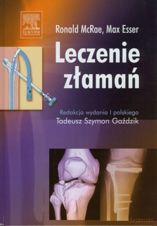 Leczenie złamań - Ronald McRae, Max Esser [KSIĄŻKA]