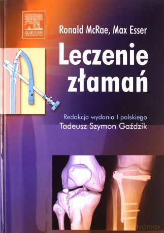 Leczenie złamań - Ronald McRae, Max Esser [KSIĄŻKA]