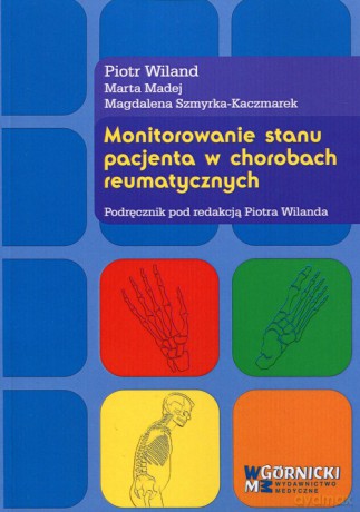 Monitorowanie stanu pacjenta w chorobach reumatycznych - Piotr Wiland, Marta Madej [KSIĄŻKA]