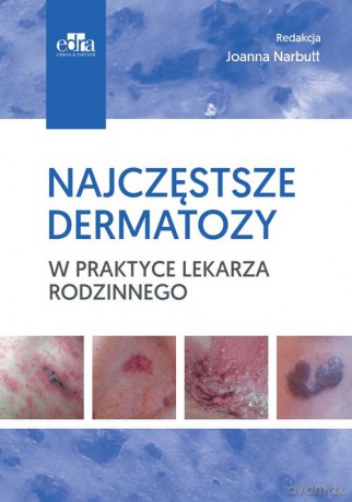 Najczęstsze dermatozy w praktyce lekarza rodzinnego [KSIĄŻKA]
