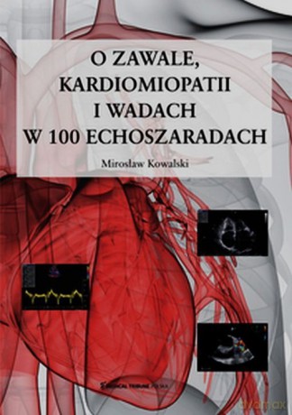O zawale kardiomiopatii i wadach w 100 echoszaradach - Mirosław Kowalski [KSIĄŻKA]