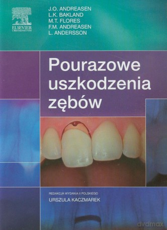 Pourazowe uszkodzenia zębów - J.O. Andreasen, L.K. Bakland [KSIĄŻKA]
