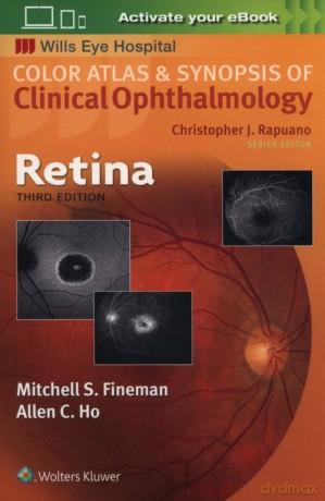 Retina - Mitchell Fineman [KSIĄŻKA]