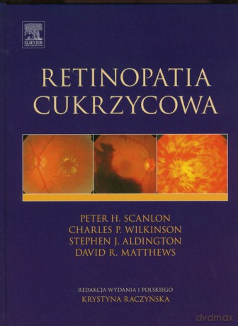 Retinopatia cukrzycowa - Peter H. Scanlon, Charles P. Wilkinson [KSIĄŻKA]
