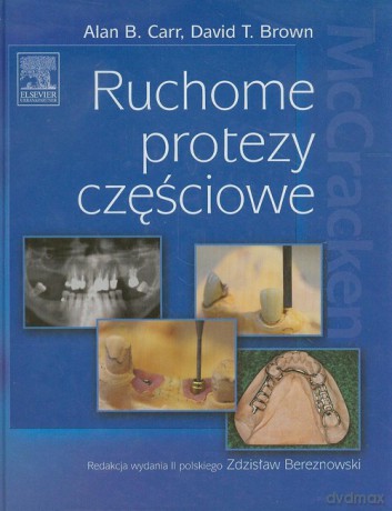 Ruchome protezy częściowe - Alan B. Carr, David T. Brown [KSIĄŻKA]