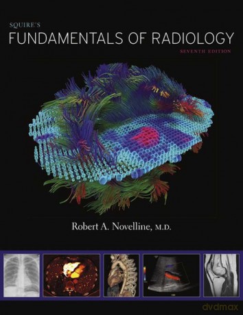 Squire's Fundamentals of Radiology - Robert A. Novelline [KSIĄŻKA]
